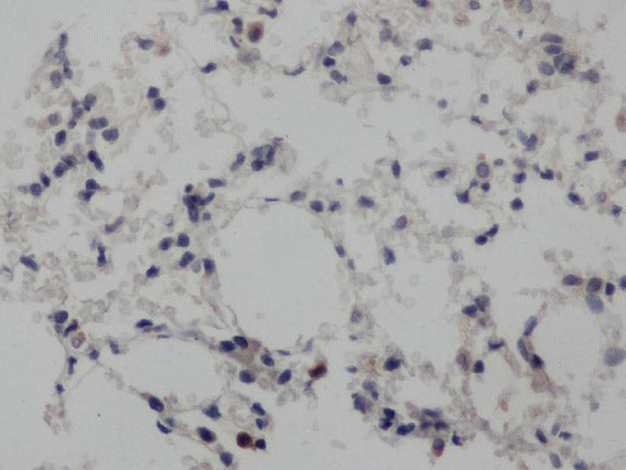 NOTCH1 Polyclonal Antibody Store at -20°C