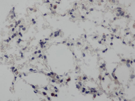 NOTCH1 Polyclonal Antibody Store at -20°C