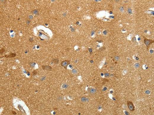 AMD1 Polyclonal Antibody Store at -20°C