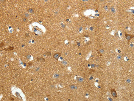 AMD1 Polyclonal Antibody Store at -20°C