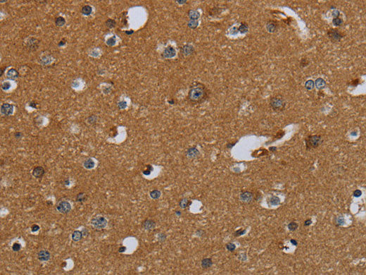 PCK2 Polyclonal Antibody Store at -20°C