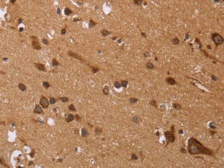 EDN3 Polyclonal Antibody Store at -20°C