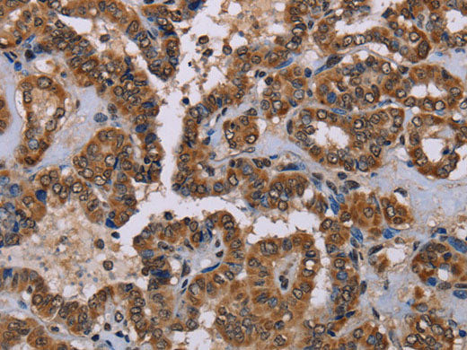 GRK1 Polyclonal Antibody Store at -20°C