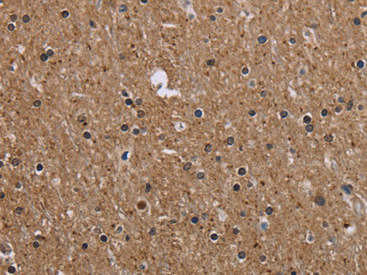 CMTM5 Polyclonal Antibody Store at -20°C