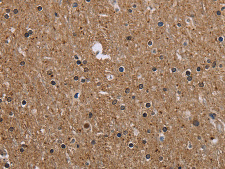 CMTM5 Polyclonal Antibody Store at -20°C