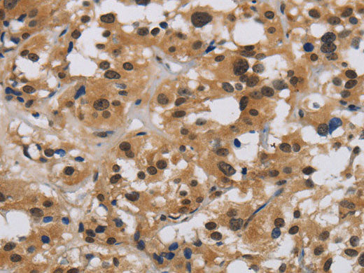 E2F4 Polyclonal Antibody Store at -20°C