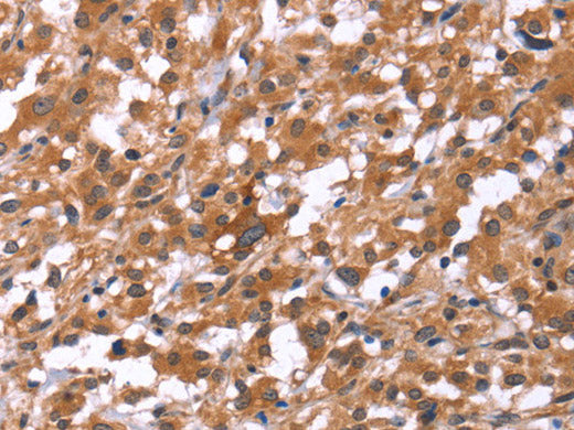 HSD17B1 Polyclonal Antibody Store at -20°C