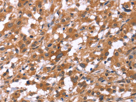HSD17B1 Polyclonal Antibody Store at -20°C