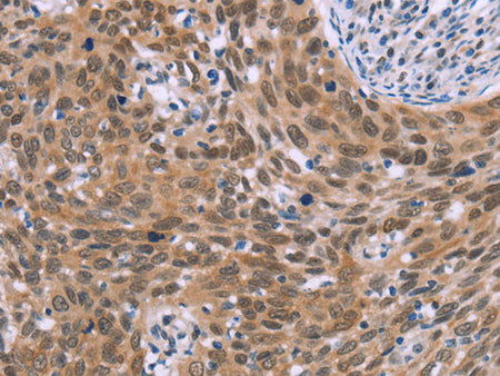 GLYR1 Polyclonal Antibody Store at -20°C