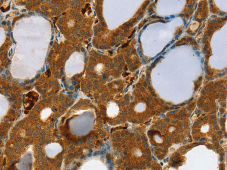 RAB27A Polyclonal Antibody Store at -20°C