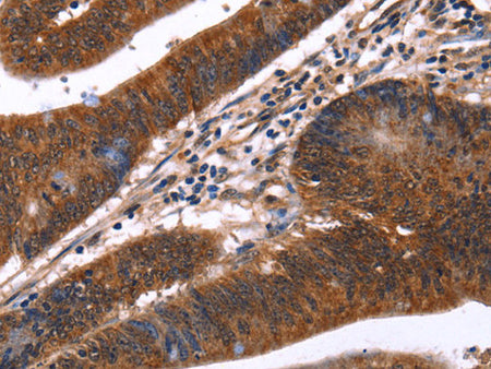 GUK1 Polyclonal Antibody Store at -20°C