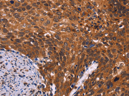 CDC5L Polyclonal Antibody Store at -20°C