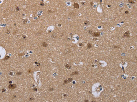 CDK5 Polyclonal Antibody Store at -20°C