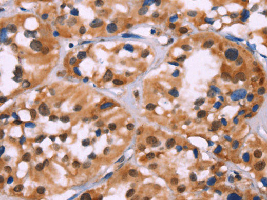 HIST1H1C Polyclonal Antibody Store at -20°C