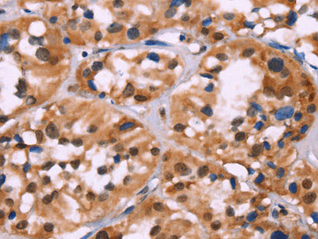HIST1H1C Polyclonal Antibody Store at -20°C
