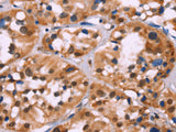 HIST1H1C Polyclonal Antibody Store at -20°C