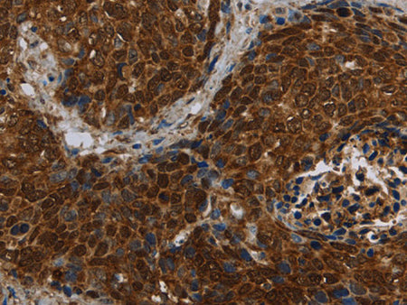 CERS5 Polyclonal Antibody Store at -20°C