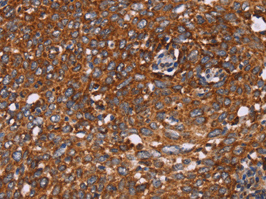 CYP2W1 Polyclonal Antibody