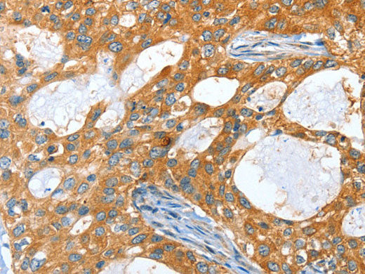AMHR2 Polyclonal Antibody
