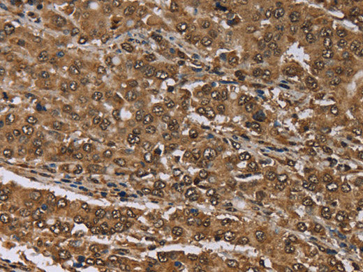 MEIS1 Polyclonal Antibody Store at -20°C