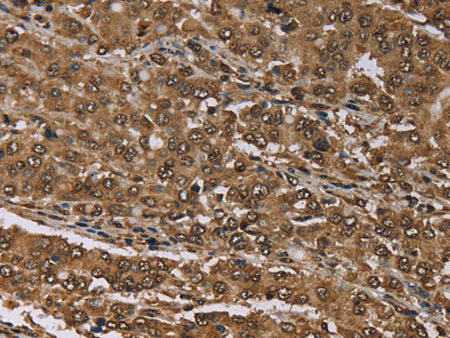 MEIS1 Polyclonal Antibody Store at -20°C