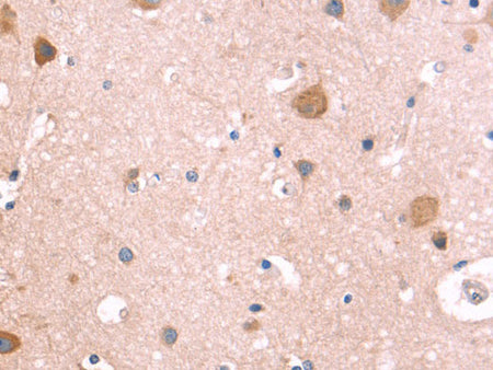 ST2 Polyclonal Antibody Store at -20°C