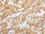 GRIN2C Polyclonal Antibody Store at -20°C