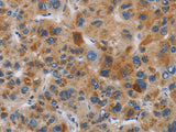IAPP Polyclonal Antibody