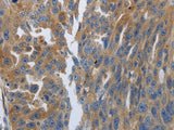 SOCS1 Polyclonal Antibody Store at -20°C