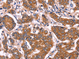 COL20A1 Polyclonal Antibody