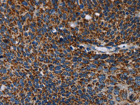 IDH2 Polyclonal Antibody Store at -20°C