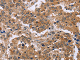 EPDR1 Polyclonal Antibody