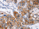 CD54 Polyclonal Antibody Store at -20°C