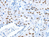 ARID1A Polyclonal Antibody Store at -20°C
