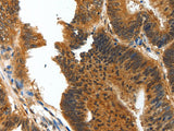 BIRC6 Polyclonal Antibody Host Rabbit