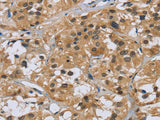 CK-5 Polyclonal Antibody