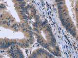 KCNJ11 Polyclonal Antibody Store at -20°C