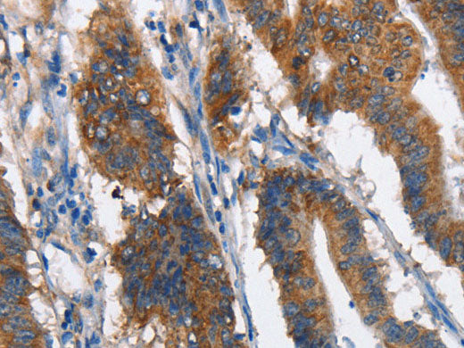 MAD2L1BP Polyclonal Antibody Store at -20°C