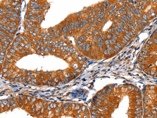 FGFR1 Polyclonal Antibody Store at -20°C