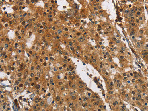 PTK6 Polyclonal Antibody Store at -20°C