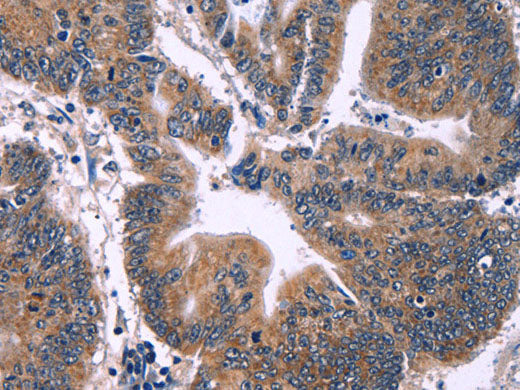 ING2 Polyclonal Antibody Store at -20°C