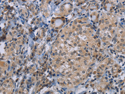 CDC16 Polyclonal Antibody Store at -20°C