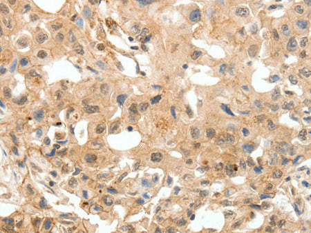 COL4A1 Polyclonal Antibody Store at -20°C