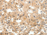 COL4A1 Polyclonal Antibody Store at -20°C