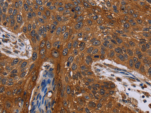 Catenin gamma Polyclonal Antibody Store at -20°C
