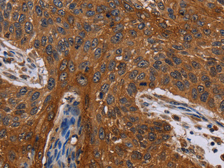 Catenin gamma Polyclonal Antibody Store at -20°C