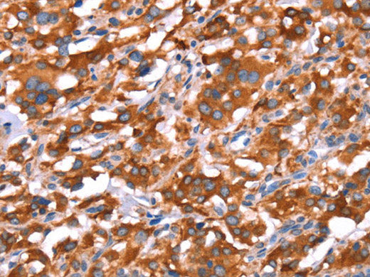 GAS8 Polyclonal Antibody Store at -20°C