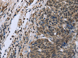 FANCG Polyclonal Antibody