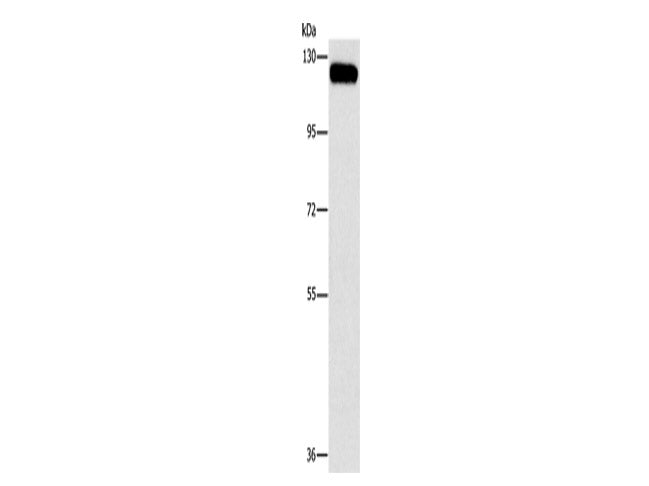 CBL Polyclonal Antibody Store at -20°C