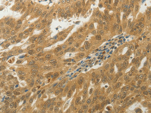 MYSM1 Polyclonal Antibody Store at -20°C